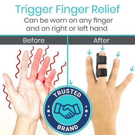 Finger Splint - Universal Finger Straightener - Broken and Trigger Finger Splints - Brace for Arthritis Pain and Support - Sprain Relief for Middle, Index, Ring, Pinky Fingers - Beige - Size 2 Pack