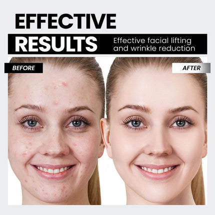 Microcurrent Facial Device,Latest Red Light Technology,Enhances The Ability to Lift The Face and Tighten The Skin,Facial Wrinkle Equipment,Smart Photon Micro-Current Device - White - Size 15cm