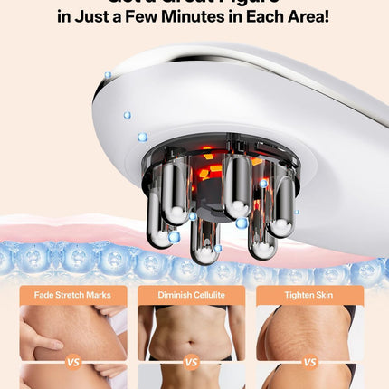 Body Sculpting Machine with Red Light Therapy for Face & Body, Cupping Therapy, Electric Cellulite Massage Tool with 2 Cups, Gift for Women - White - Size 14cm