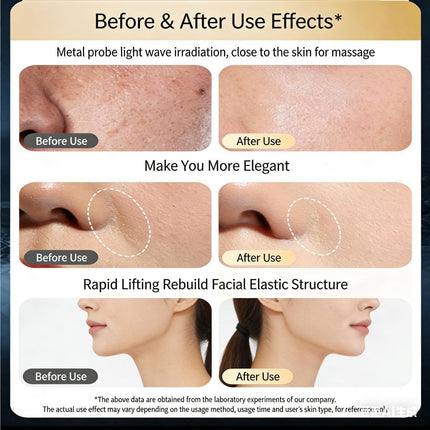 At-Home Facial Massager Beauty Device