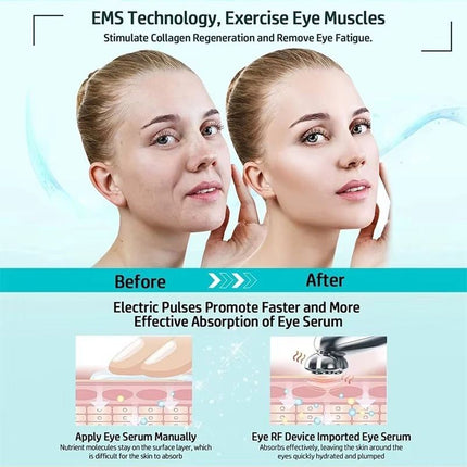 Eye Beauty Device Eye Care Anti-Aging Dark Circles Puffiness Fine Lines