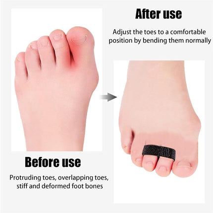 Hook and Loop Finger Wrap,Tutuviw 10 Pcs Washable and Reusable Buddy Straps for Fingers,Buddy Tape Finger Straps,Toe Separator for Bunion,Finger Brace for Injured/Jammed/Trigger Finger Support(Black) Black