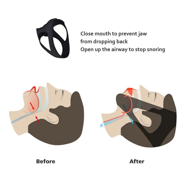 Adjustable Anti Snoring Chin Strap Black Stop Snoring Belt – product detail