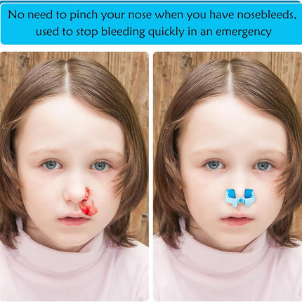Nose Stop Clips Nasal Nose Stopper Clips Plastic Foam for Emergency or Accident