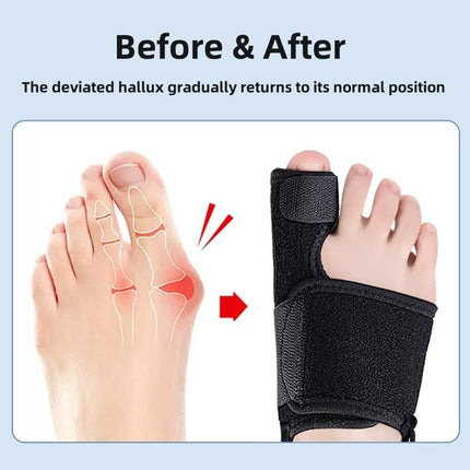 Recovist Bunion Brace - Adjustable Orthopedic Splint for Hallux Valgus Correction & Pain Relief, Day & Night Wear Support for Men & Women (2PC)