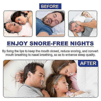 Anti-snoring Tape Nasal Breathing Stickers Anti-opening Snoring Breathing