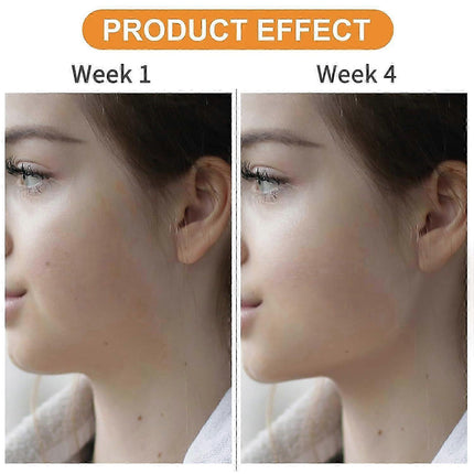 Jaw Exerciser, Jawline Exerciser, Jaw Exerciser for Women Men, Jaw Excersizer for Chisell and Define Your Jawline