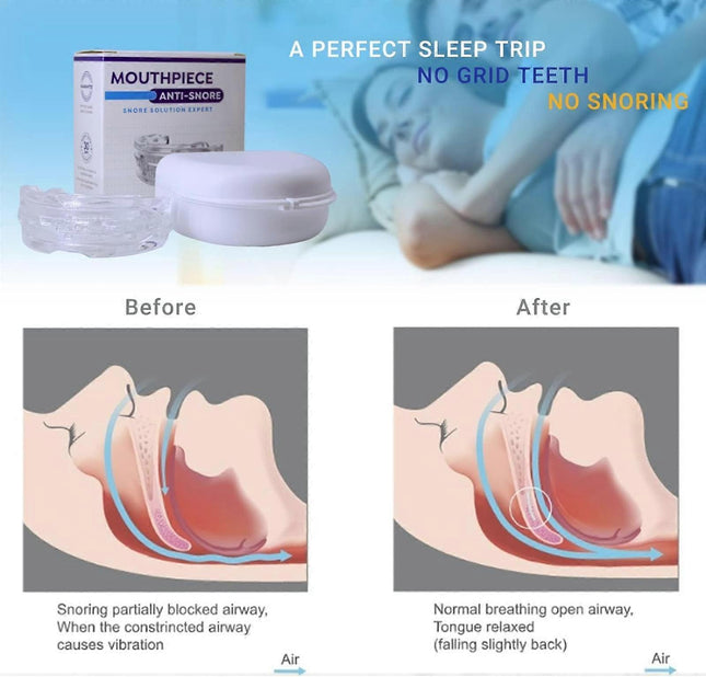 Anti-snoring devices adjustable anti-snoring devices snoring aids for men and women aids – product detail