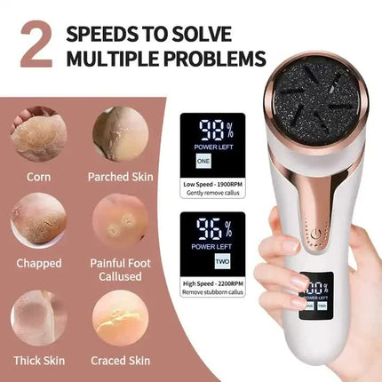 White Electric Foot Callus Remover – product detail
