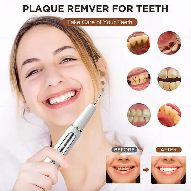 White Portable Ultrasonic Dental Cleaner Home Use Plaque Remover Sonic Tooth Stain & Tartar Cleaning Tool – product detail