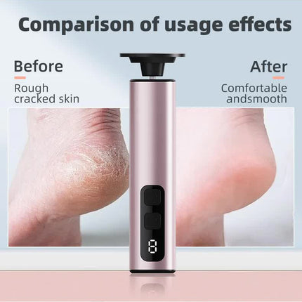 Purple Rechargeable Electric Foot File with 9 Speed Settings - Callus Remover for Smooth Feet