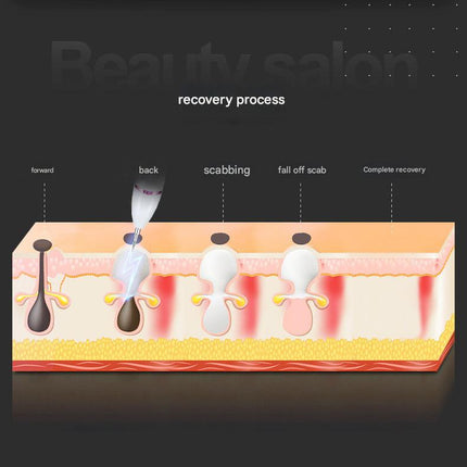 Professional 9-Level Skin Tag & Spot Remover Pen – product features