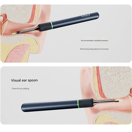 Smart Visual Ear Cleaner with HD Endoscope & Precision Tweezers - Safe for Adults & Children(White)