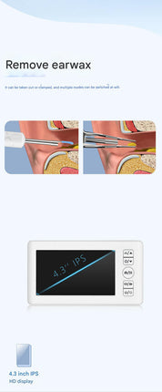 All-in-One Wireless Visual Ear Cleaner Kit with 4.3" IPS Display Screen(white)