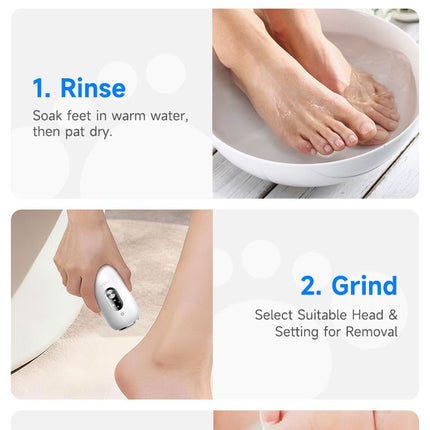 White 2-in-1 Electric Foot Care Device – Cordless Callus Remover & Skin Polisher with Dual Heads