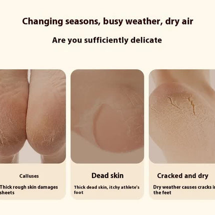 Electric Foot Callus Remover Rechargeable Pedicure Tool with 3 Grinding Heads Portable Dead Skin Exfoliator Ivory White