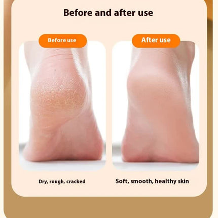 Electric Foot Callus Remover Rechargeable Pedicure Tool with 3 Grinding Heads Portable Dead Skin Exfoliator Peach Pink