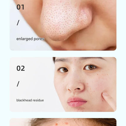 White Heated Micro-Bubble Blackhead Remover Vacuum Pore Cleaner - 46C Hot Compress Electric Water Cycle Facial Cleansing Device with 6 Suction Heads 3 Modes