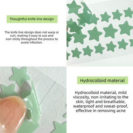 Star Acne Patches Pink 5 Sheets - 40 Stars Per Sheet, Hydrocolloid Blemish Stickers, Waterproof Sweat-Resistant Star Pimple Covers